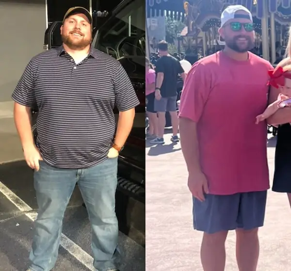 Dr. Lawrence Before and After
