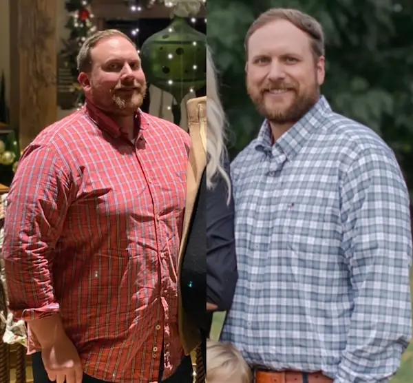 Dr. Lawrence Before and After